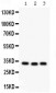 Anti-GC1q R Picoband Antibody